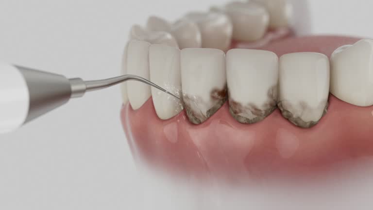 Reliable Dental Crowns And Bridges contractor in Hughes County County, SD by Dentist Open Now